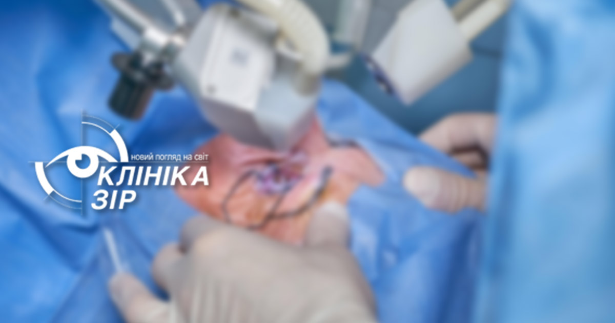 Життя без окулярів: який метод хірургічної корекції підійде саме вам?