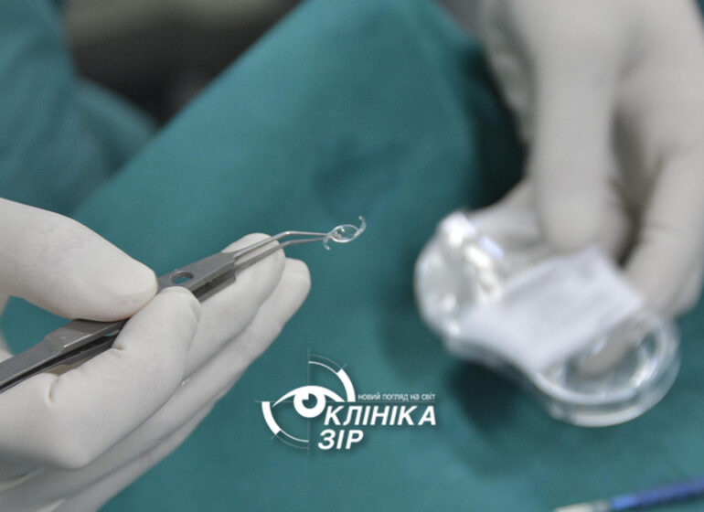 Як ми виправляємо астигматизм у клініці