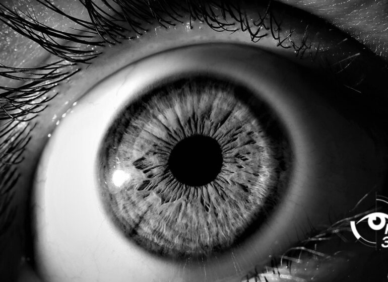 Пісок в очах - синдром сухого ока