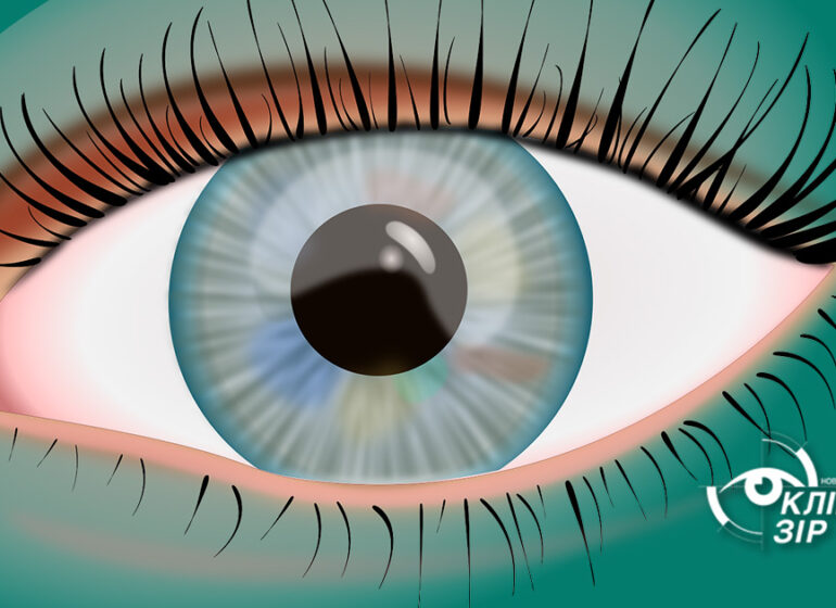 Косоокість у дитини