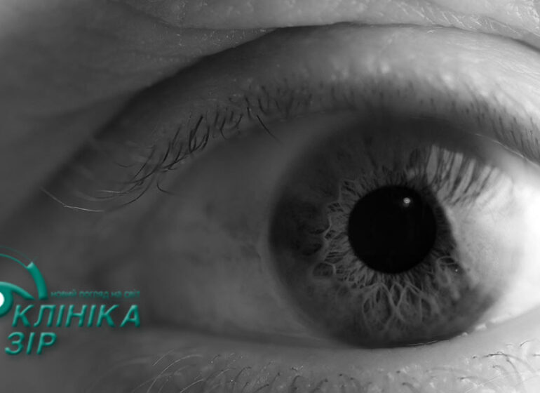 Мушки перед очима