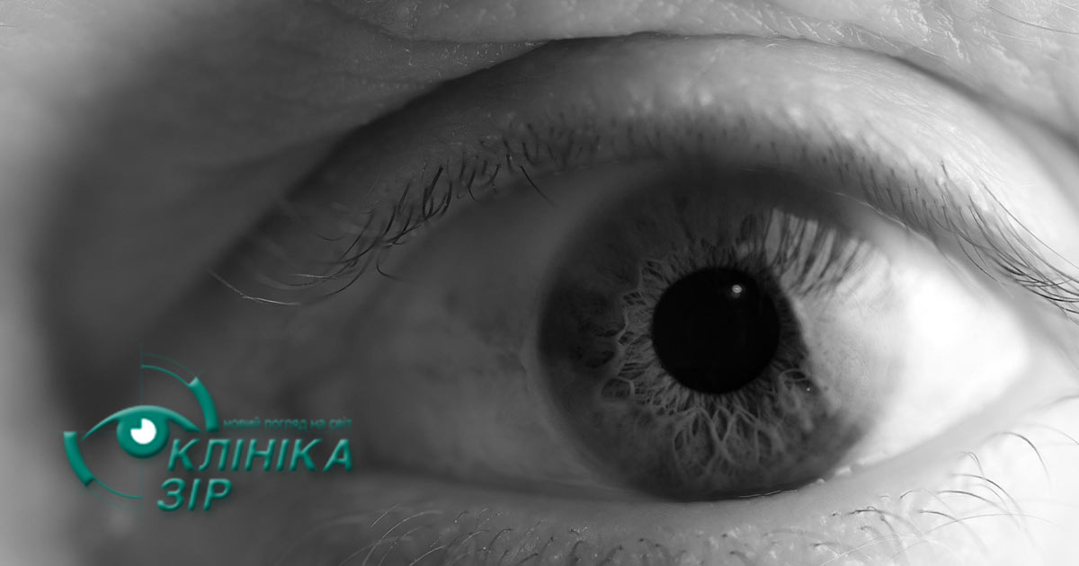 Мушки перед очима